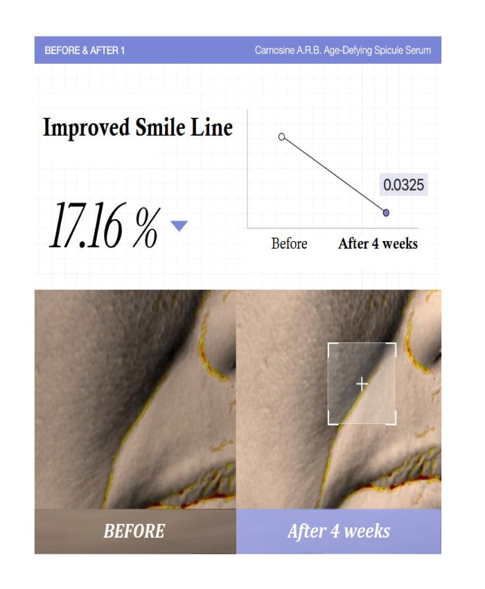 YYY LAB - CARNOSINE A.R.B AGE-DEFYING Spicule Serum 30ml