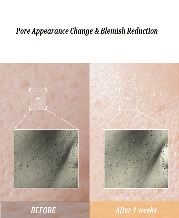 YYY LAB - ZINC-HAZEL Pore Minimizing Infusion 30ml