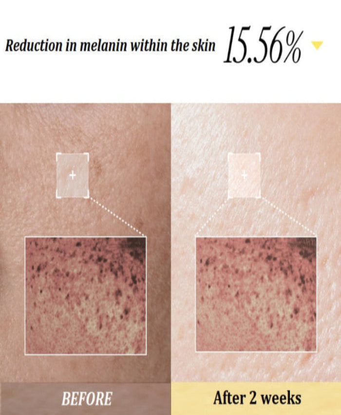 YYY LAB - White Mulberry B3 Glow & Brightening Activator 30ml