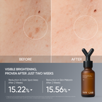 YYYLAB - Complete Care 4-Piece Skincare Set