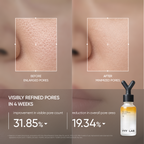 YYYLAB - ZINC-HAZEL Pore Minimizing Infusion 30ml