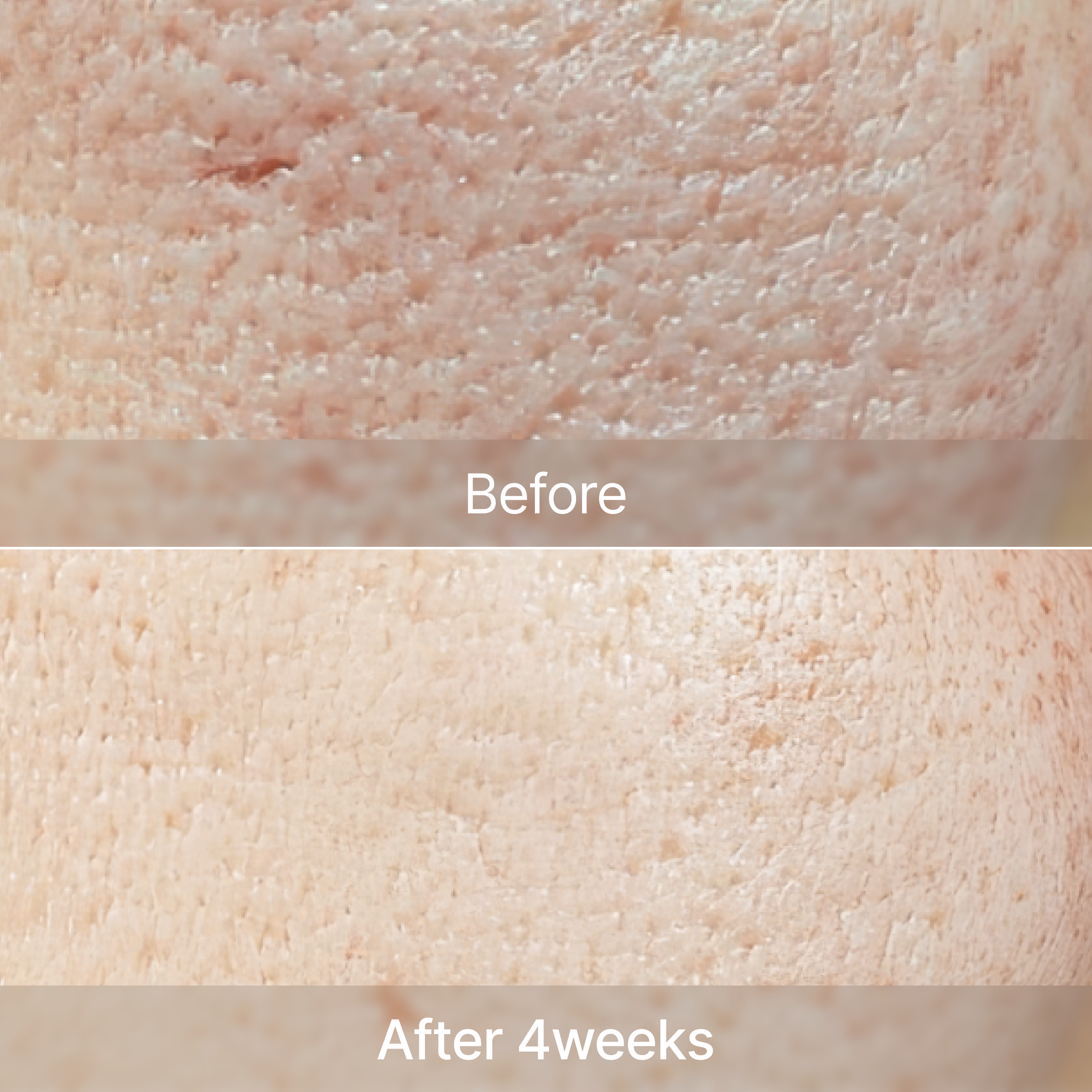 ZINC-HAZEL Pore Minimizing Infusion 30ml