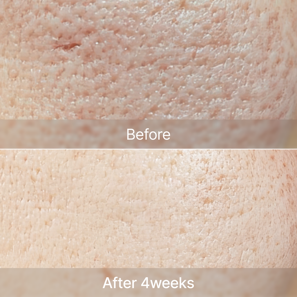 YYYLAB - Glass Skin Duo (ZINC-HAZEL Pore Minimizing Infusion + CARNOSINE PDRN Age Defying Complex)
