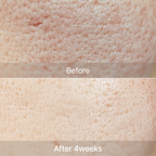 YYYLAB - Glass Skin Duo (ZINC-HAZEL Pore Minimizing Infusion + CARNOSINE PDRN Age Defying Complex)