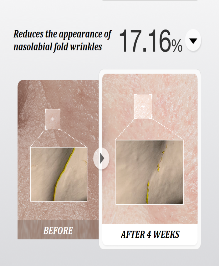 YYY LAB - CARNOSINE PDRN Age Defying Complex 50ml