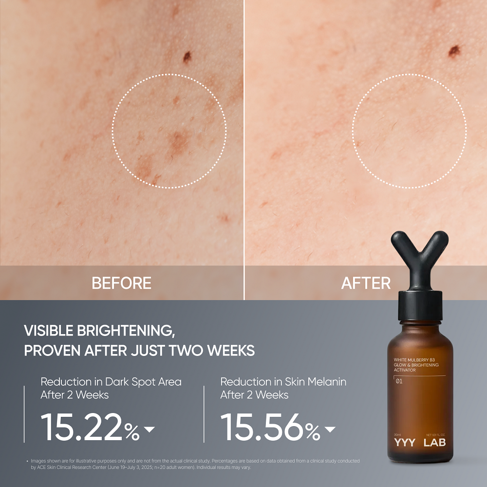 YYY LAB - Complete Care 3 Piece Ampoule Set (Brightening, Pore Refining & Age-Defying)