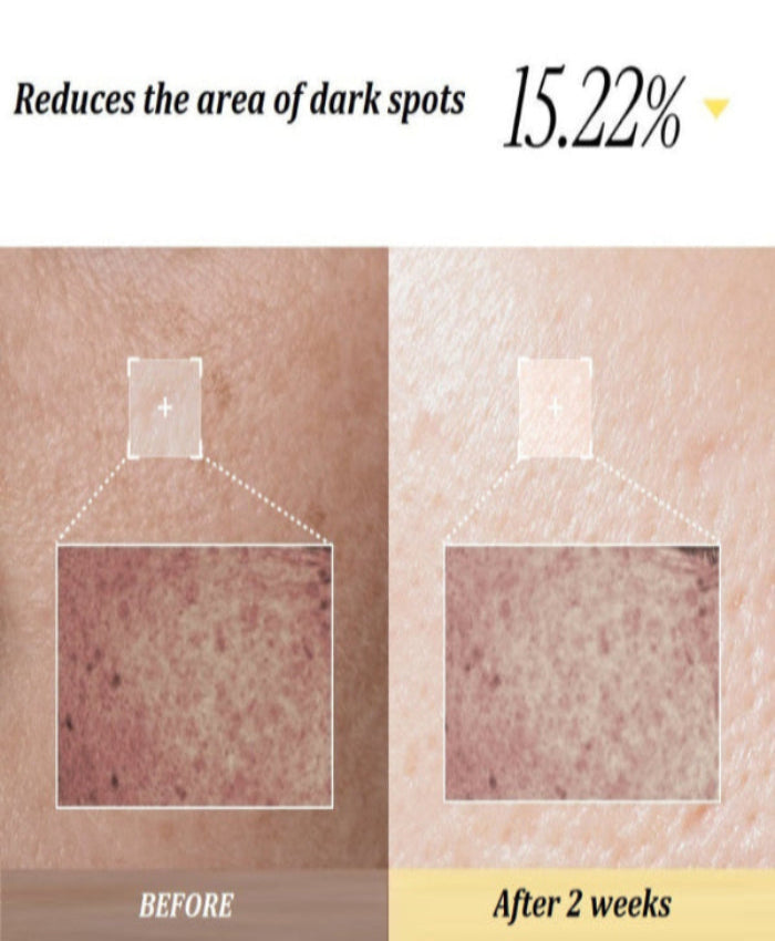 YYY LAB - White Mulberry B3 Glow & Brightening Activator 30ml