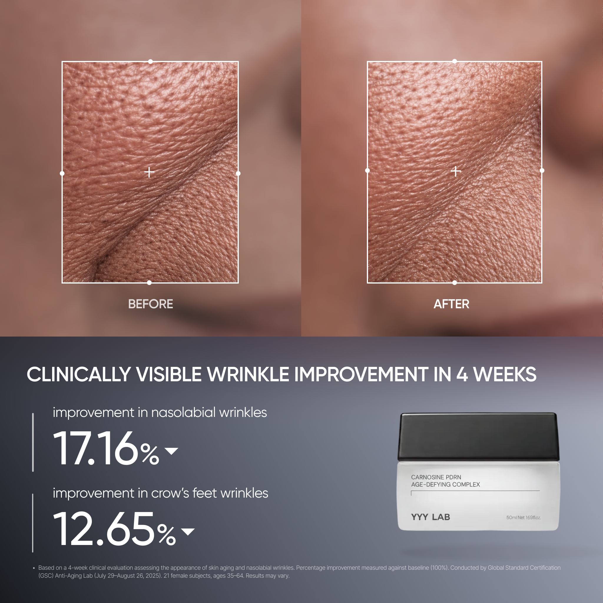 YYYLAB - CARNOSINE Double Repair SET (A.R.B Serum 30ml + Carnosine PDRN Cream 50ml)