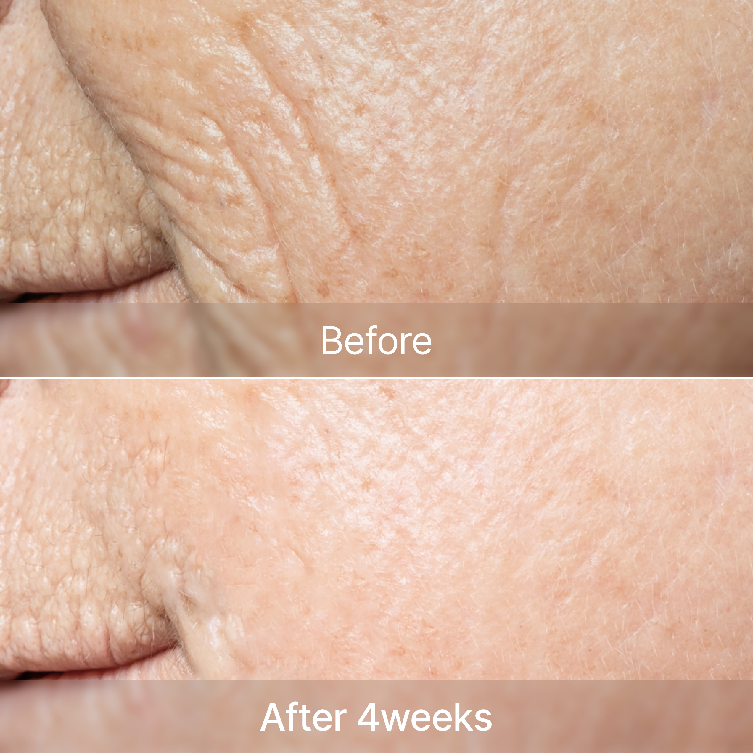 CARNOSINE PDRN Age Defying Complex 50ml