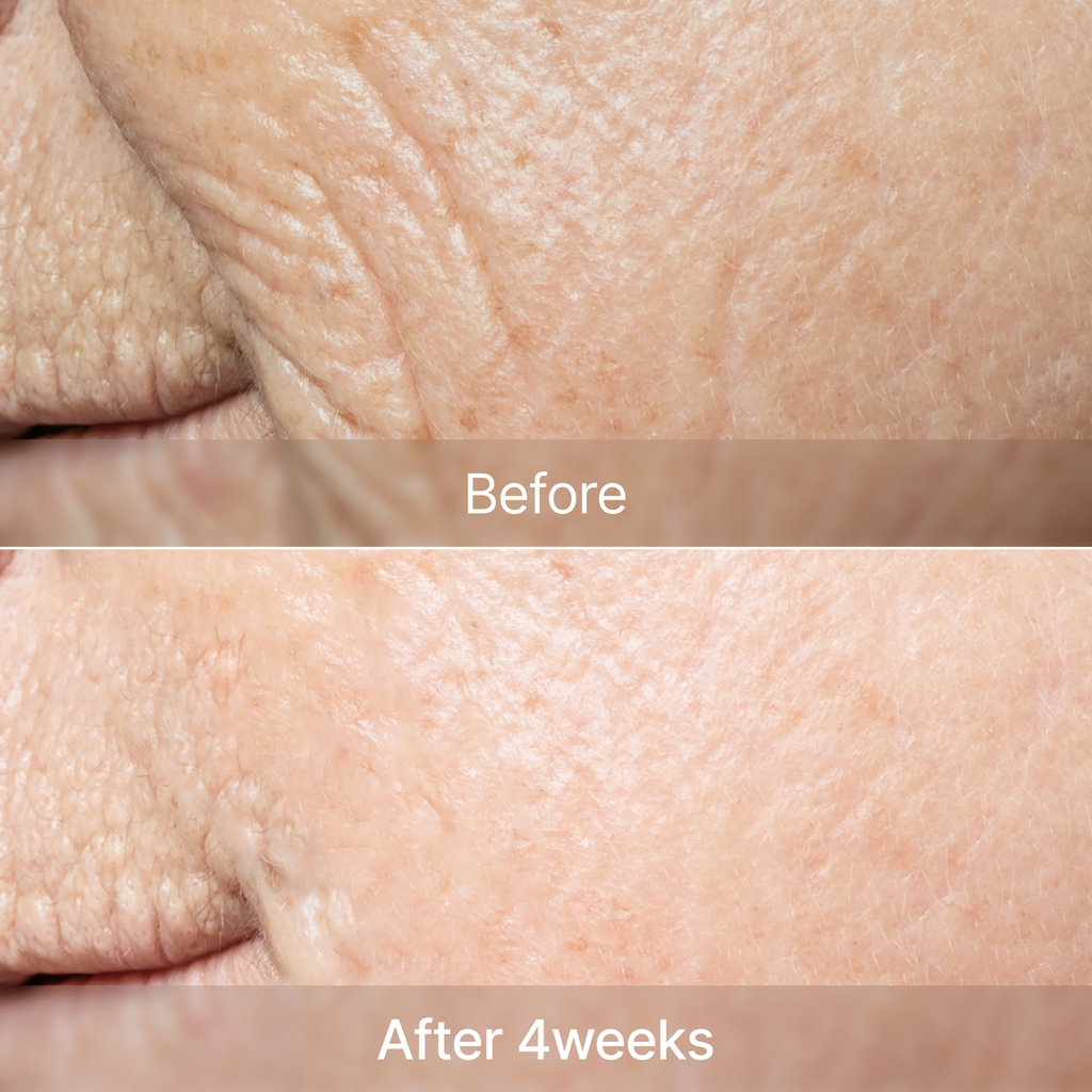 YYYLAB - Complete Care 4-Piece Skincare Set