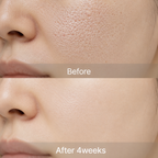 YYYLAB - ZINC-HAZEL Pore Minimizing Infusion 30ml