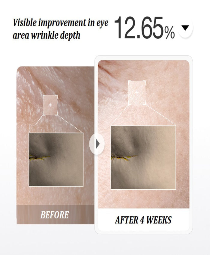 YYY LAB - CARNOSINE PDRN Age Defying Complex 50ml